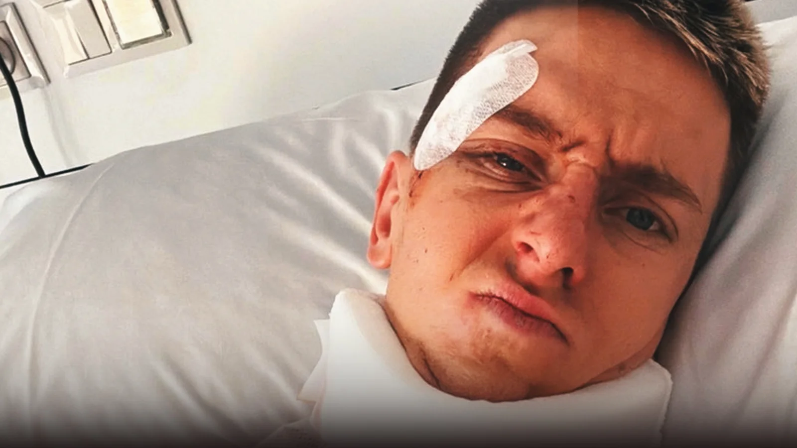 Pogacar necesita cirugía por fractura de clavícula tras caída en la Vuelta a España